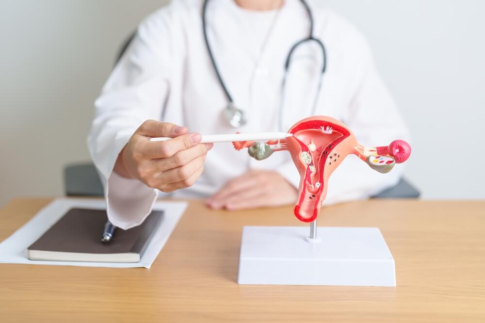 Medical professional describing UFE